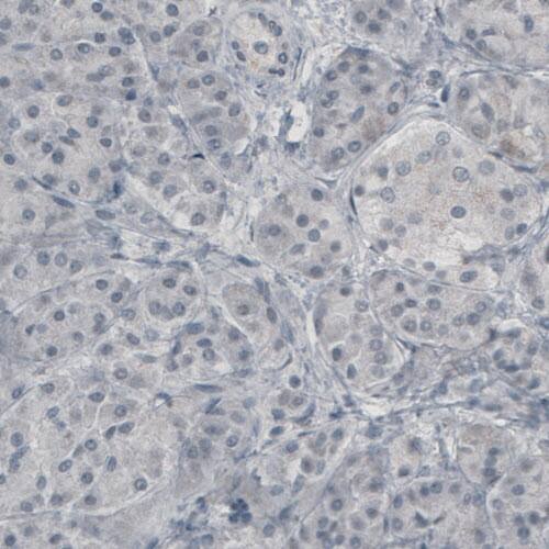 Glutamine Synthetase Antibody (CL2999) - Azide and BSA Free Immunohistochemistry-Paraffin: Glutamine Synthetase Antibody [NBP3-43805]