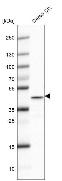 Glutamine Synthetase Antibody (CL2999) - Azide and BSA Free Western Blot: Glutamine Synthetase Antibody [NBP3-43805]