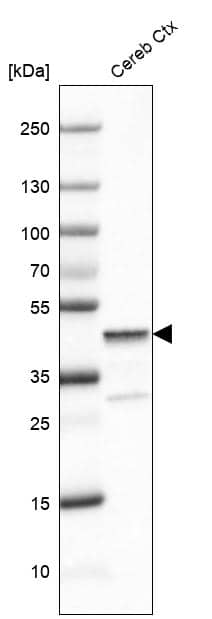 Glutamine Synthetase Antibody (CL2999) - Azide and BSA Free Western Blot: Glutamine Synthetase Antibody [NBP3-43805]
