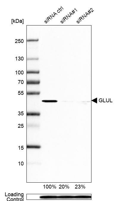 Glutamine Synthetase Antibody (CL2999) - Azide and BSA Free Western Blot: Glutamine Synthetase Antibody [NBP3-43805]