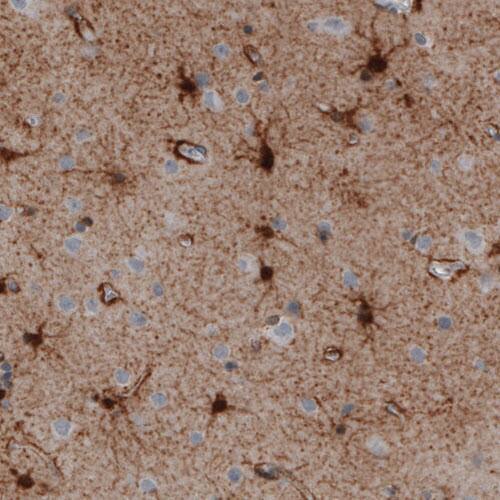 Glutamine Synthetase Antibody (CL3004) - Azide and BSA Free Immunohistochemistry-Paraffin: Glutamine Synthetase Antibody [NBP3-43806]