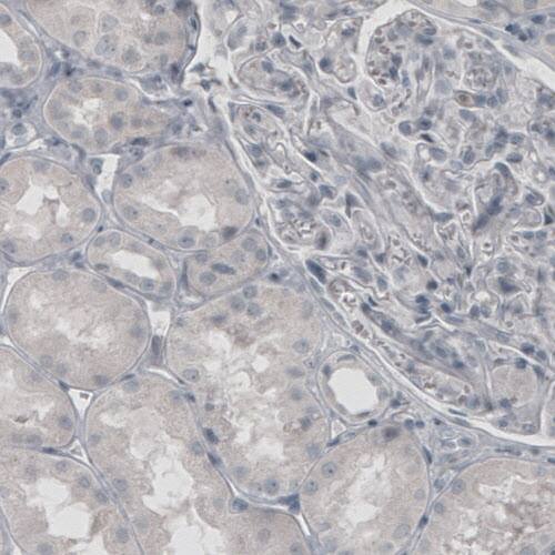 Glutamine Synthetase Antibody (CL3004) - Azide and BSA Free Immunohistochemistry-Paraffin: Glutamine Synthetase Antibody [NBP3-43806]