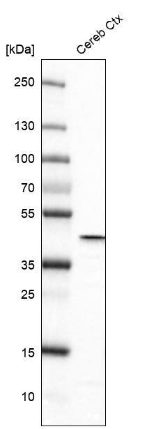 Glutamine Synthetase Antibody (CL3004) - Azide and BSA Free Western Blot: Glutamine Synthetase Antibody [NBP3-43806]