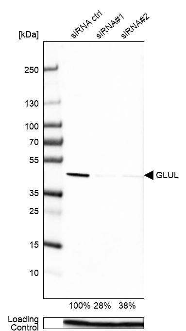 Glutamine Synthetase Antibody (CL3004) - Azide and BSA Free Western Blot: Glutamine Synthetase Antibody [NBP3-43806]