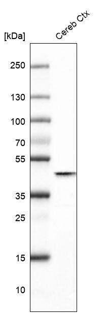 Glutamine Synthetase Antibody (CL3004) - Azide and BSA Free Western Blot: Glutamine Synthetase Antibody [NBP3-43806]