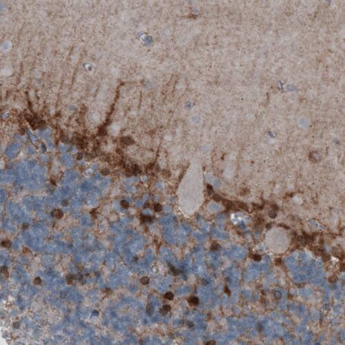 Glutamine Synthetase Antibody (CL3013) - Azide and BSA Free Immunohistochemistry-Paraffin: Glutamine Synthetase Antibody [NBP3-43807]