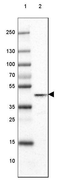 Glutamine Synthetase Antibody (CL3013) - Azide and BSA Free Western Blot: Glutamine Synthetase Antibody [NBP3-43807]