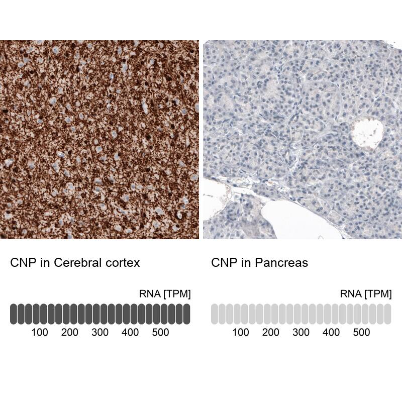 CNPase Antibody (CL2887) - Azide and BSA Free Immunohistochemistry-Paraffin: CNPase Antibody [NBP3-43808]