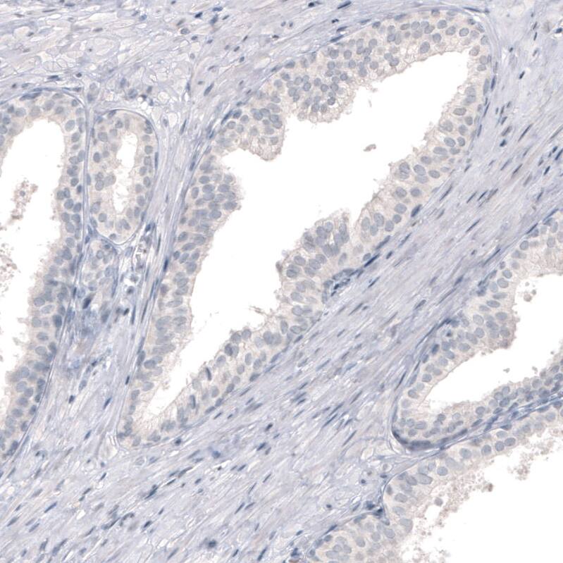 CNPase Antibody (CL2871) - Azide and BSA Free Immunohistochemistry-Paraffin: CNPase Antibody [NBP3-43809]