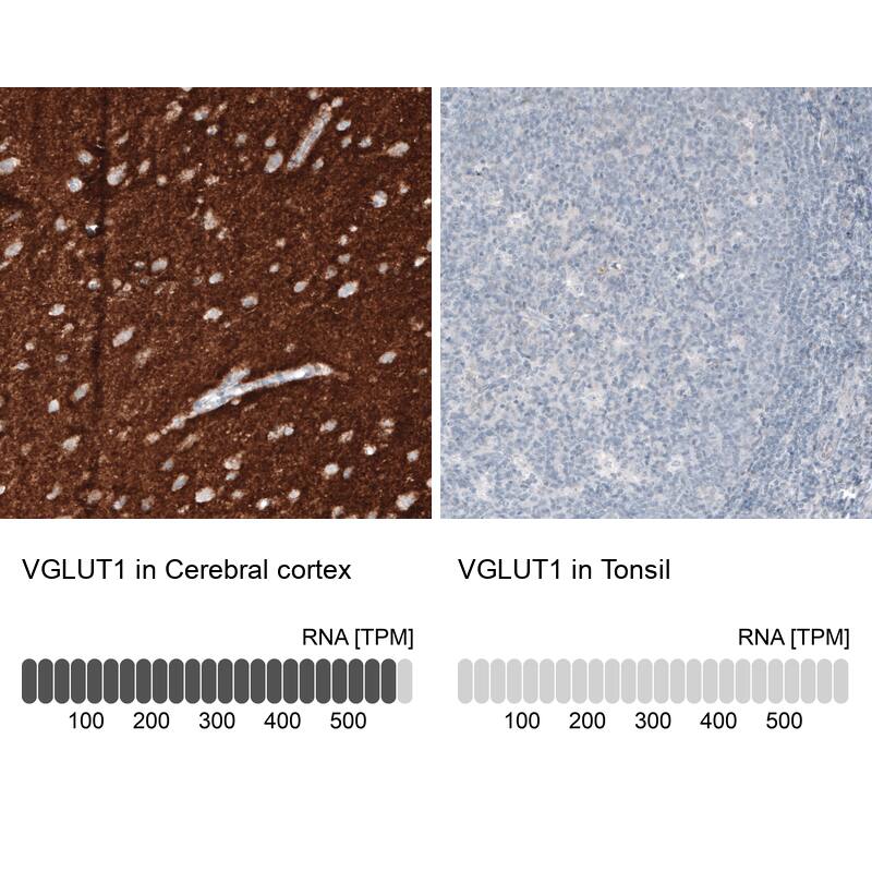 VGLUT1 Antibody (CL2754) - Azide and BSA Free Immunohistochemistry-Paraffin: VGLUT1 Antibody [NBP3-43811]