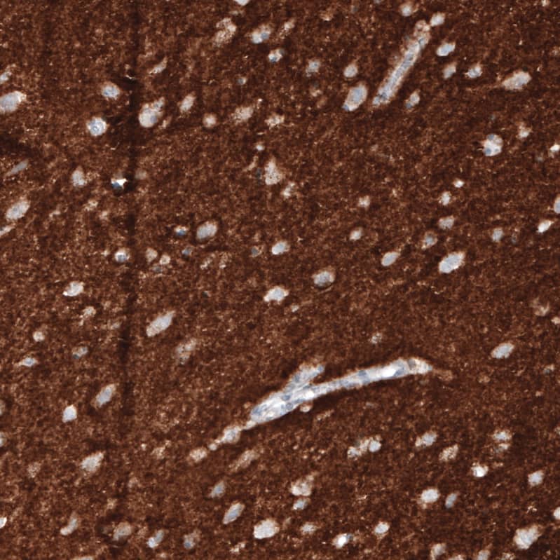 VGLUT1 Antibody (CL2754) - Azide and BSA Free Immunohistochemistry-Paraffin: VGLUT1 Antibody [NBP3-43811]