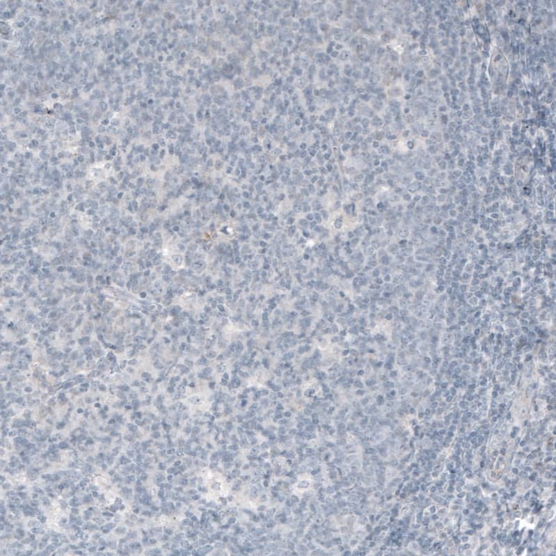 VGLUT1 Antibody (CL2754) - Azide and BSA Free Immunohistochemistry-Paraffin: VGLUT1 Antibody [NBP3-43811]