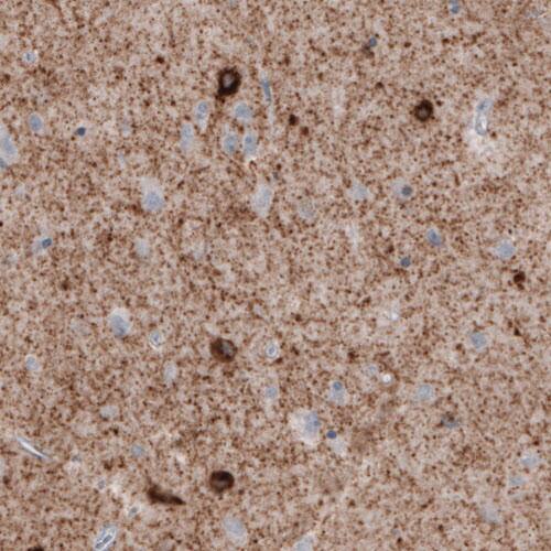 GAD1/GAD67 Antibody (CL2911) - Azide and BSA Free Immunohistochemistry-Paraffin: GAD1/GAD67 Antibody [NBP3-43812]