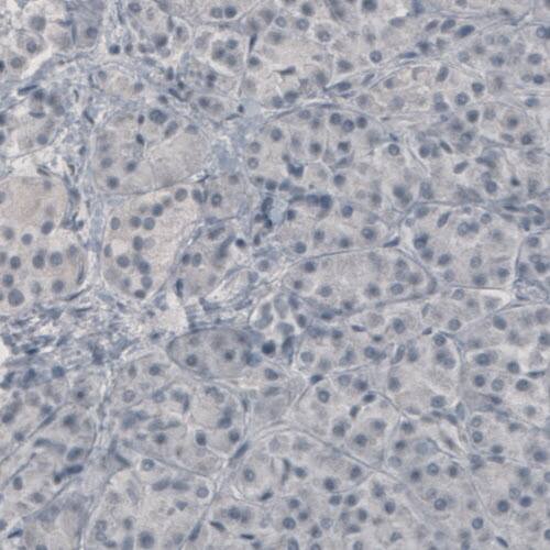 GAD1/GAD67 Antibody (CL2911) - Azide and BSA Free Immunohistochemistry-Paraffin: GAD1/GAD67 Antibody [NBP3-43812]