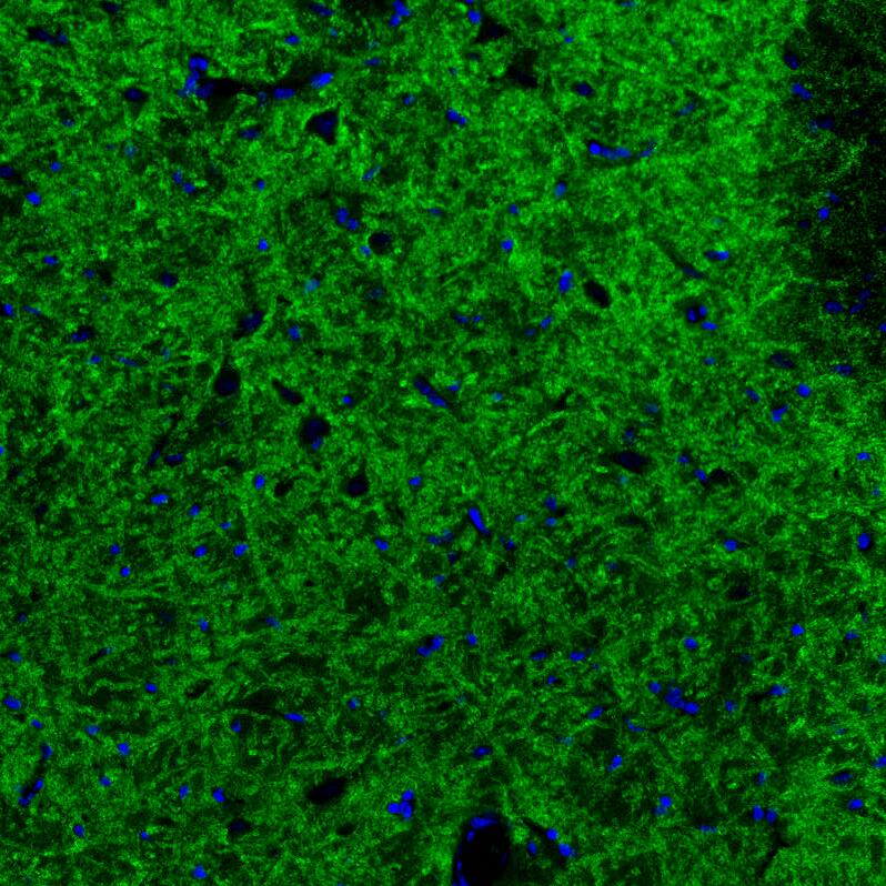 GAD2/GAD65 Antibody (CL2736) - Azide and BSA Free Immunohistochemistry-Paraffin: GAD2/GAD65 Antibody [NBP3-43815]