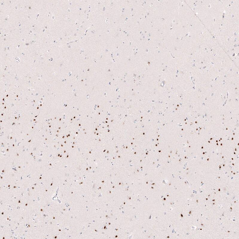 FoxP2 Antibody (CL5310) - Azide and BSA Free Immunohistochemistry-Paraffin: FoxP2 Antibody [NBP3-43816]