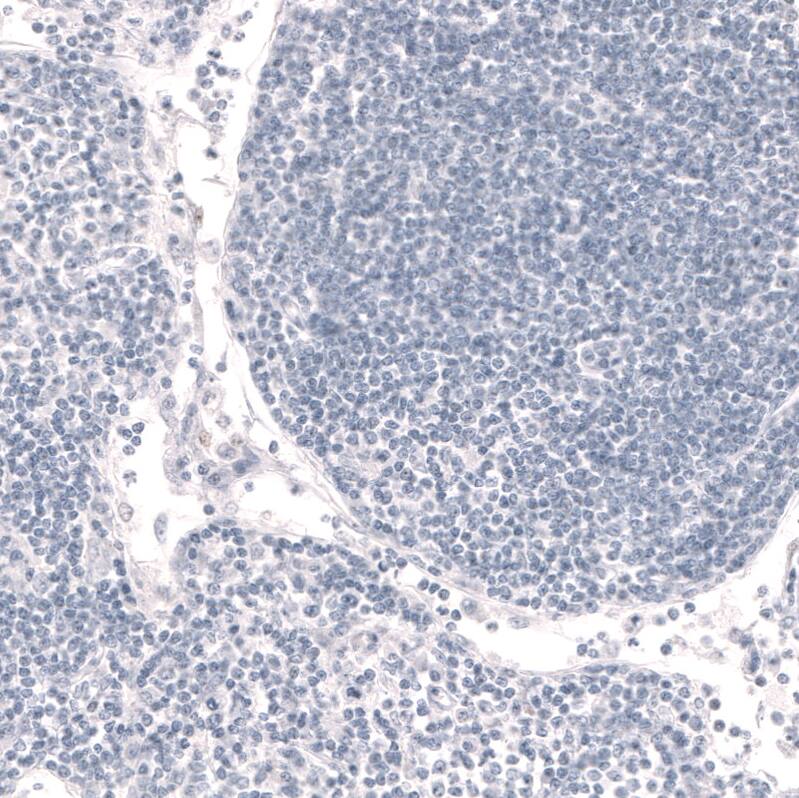 FoxP2 Antibody (CL5310) - Azide and BSA Free Immunohistochemistry-Paraffin: FoxP2 Antibody [NBP3-43816]