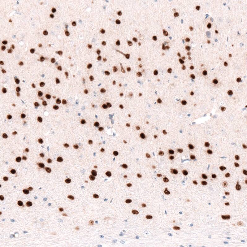 FoxP2 Antibody (CL5310) - Azide and BSA Free Immunohistochemistry-Paraffin: FoxP2 Antibody [NBP3-43816]
