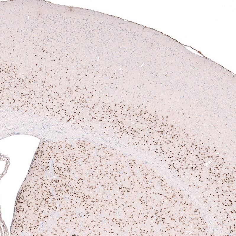 FoxP2 Antibody (CL5310) - Azide and BSA Free Immunohistochemistry-Paraffin: FoxP2 Antibody [NBP3-43816]