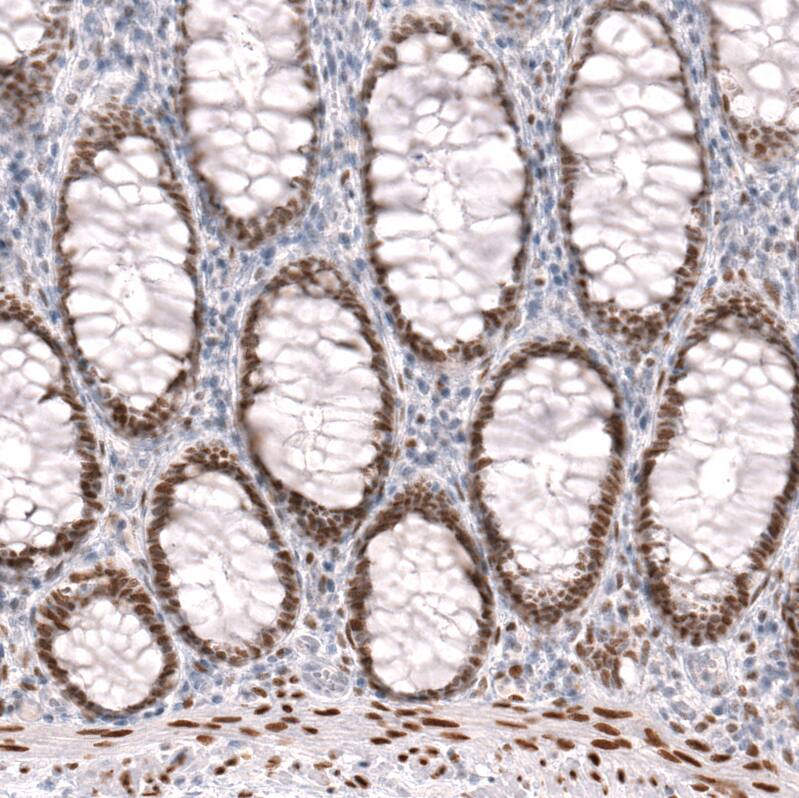 FoxP2 Antibody (CL5310) - Azide and BSA Free Immunohistochemistry-Paraffin: FoxP2 Antibody [NBP3-43816]