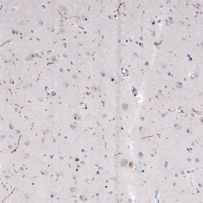 Tryptophan hydroxylase 2 Antibody (CL2990) - Azide and BSA Free Immunohistochemistry-Paraffin: Tryptophan hydroxylase 2 Antibody [NBP3-43817]
