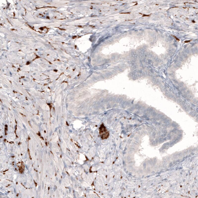 NET1 Antibody (CL3063) - Azide and BSA Free Immunohistochemistry-Paraffin: NET1 Antibody [NBP3-43818]
