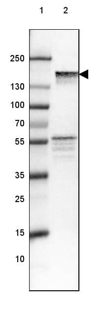 NF-M Antibody (CL2678) - Azide and BSA Free Western Blot: NF-M Antibody [NBP3-43819]