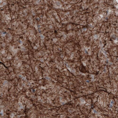 NF-M Antibody (CL2678) - Azide and BSA Free Immunohistochemistry-Paraffin: NF-M Antibody [NBP3-43819]