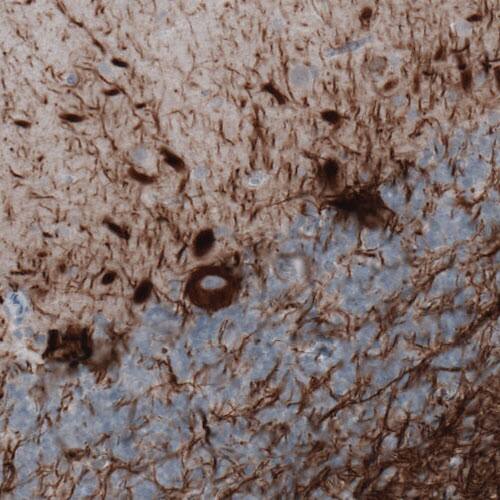 NF-M Antibody (CL2688) - Azide and BSA Free Immunohistochemistry-Paraffin: NF-M Antibody [NBP3-43820]