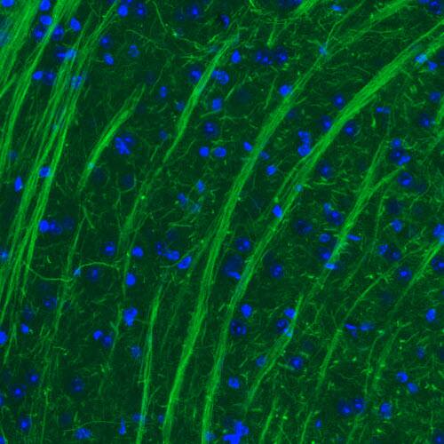 NF-M Antibody (CL2688) - Azide and BSA Free Immunohistochemistry-Paraffin: NF-M Antibody [NBP3-43820]