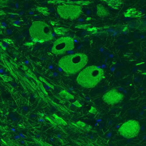 NF-M Antibody (CL2688) - Azide and BSA Free Immunohistochemistry-Paraffin: NF-M Antibody [NBP3-43820]