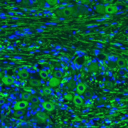 NF-M Antibody (CL2688) - Azide and BSA Free Immunohistochemistry-Paraffin: NF-M Antibody [NBP3-43820]