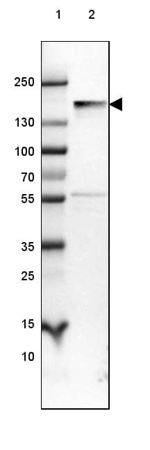 NF-M Antibody (CL2697) - Azide and BSA Free Western Blot: NF-M Antibody [NBP3-43821]