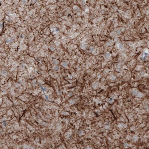 NF-M Antibody (CL2697) - Azide and BSA Free Immunohistochemistry-Paraffin: NF-M Antibody [NBP3-43821]