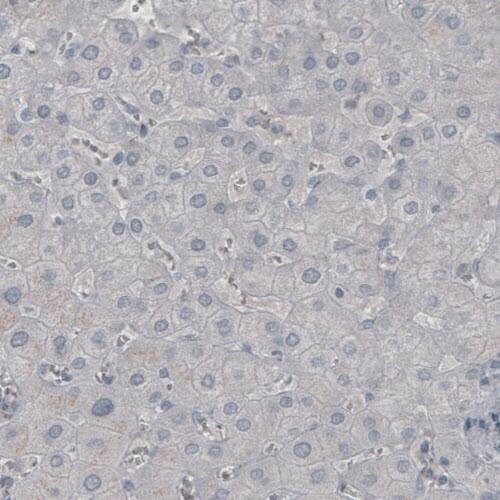 NF-M Antibody (CL2697) - Azide and BSA Free Immunohistochemistry-Paraffin: NF-M Antibody [NBP3-43821]