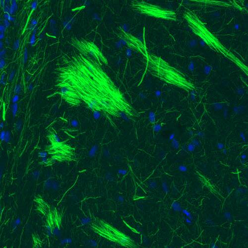 NF-M Antibody (CL2697) - Azide and BSA Free Immunohistochemistry-Paraffin: NF-M Antibody [NBP3-43821]