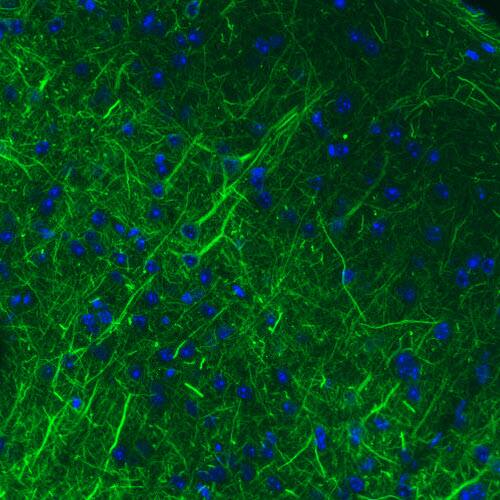 NF-M Antibody (CL2697) - Azide and BSA Free Immunohistochemistry-Paraffin: NF-M Antibody [NBP3-43821]