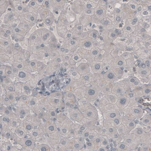 NF-M Antibody (CL2705) - Azide and BSA Free Immunohistochemistry-Paraffin: NF-M Antibody [NBP3-43822]