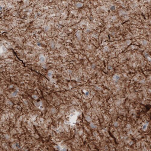NF-M Antibody (CL2705) - Azide and BSA Free Immunohistochemistry-Paraffin: NF-M Antibody [NBP3-43822]