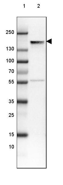 NF-M Antibody (CL2705) - Azide and BSA Free Western Blot: NF-M Antibody [NBP3-43822]
