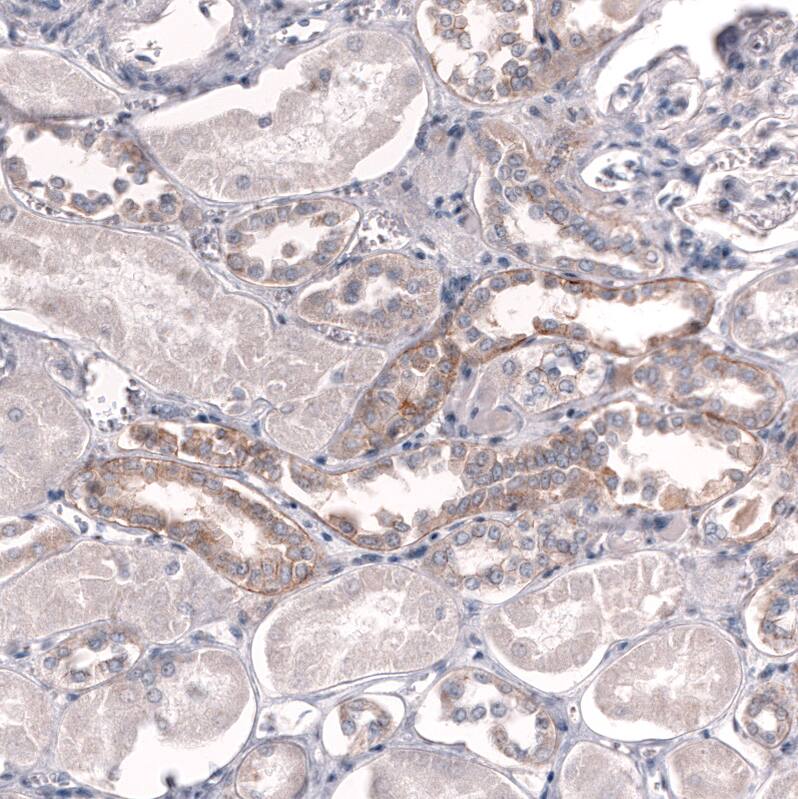 ADAM10 Antibody (CL13808) - Azide and BSA Free Immunohistochemistry-Paraffin: ADAM10 Antibody [NBP3-43825]