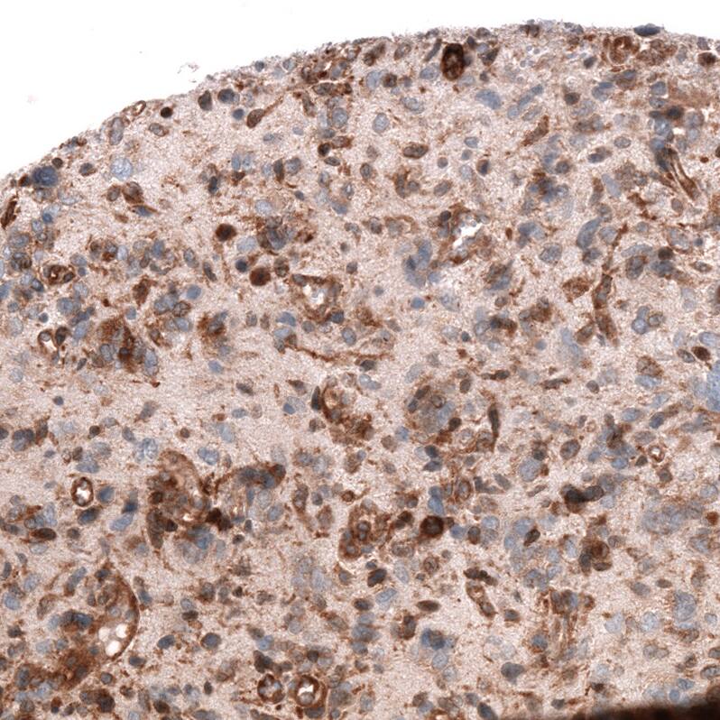 ADAM10 Antibody (CL13808) - Azide and BSA Free Immunohistochemistry-Paraffin: ADAM10 Antibody [NBP3-43825]