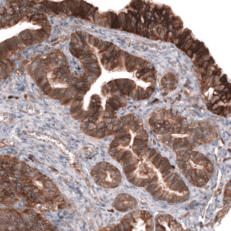 ADAM10 Antibody (CL13808) - Azide and BSA Free Immunohistochemistry-Paraffin: ADAM10 Antibody [NBP3-43825]
