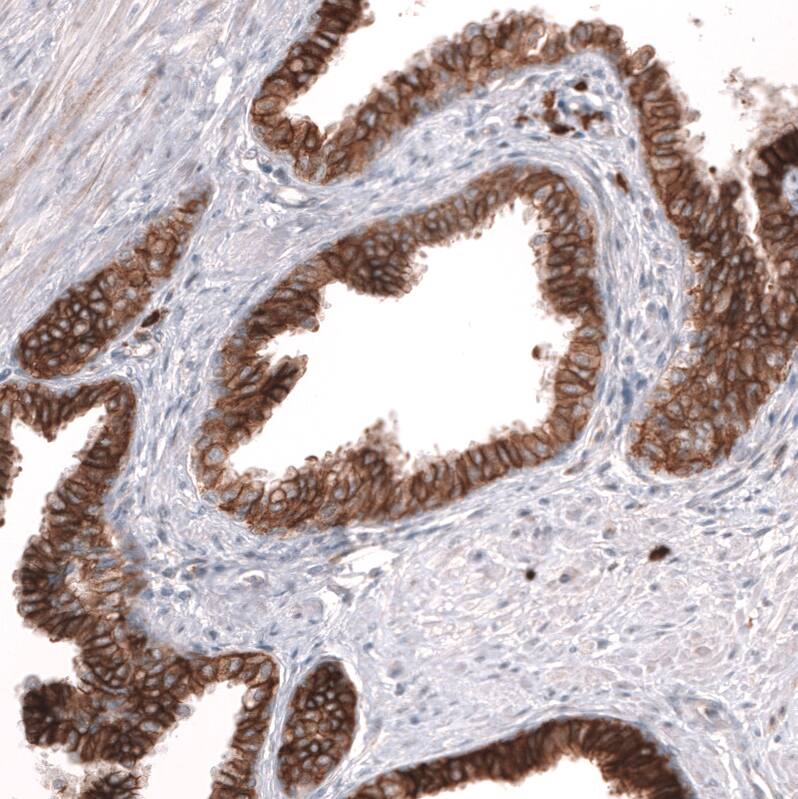 ADAM10 Antibody (CL13808) - Azide and BSA Free Immunohistochemistry-Paraffin: ADAM10 Antibody [NBP3-43825]