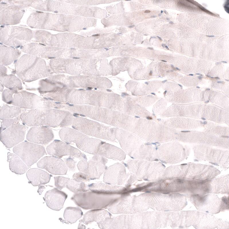 ADAM10 Antibody (CL13808) - Azide and BSA Free Immunohistochemistry-Paraffin: ADAM10 Antibody [NBP3-43825]