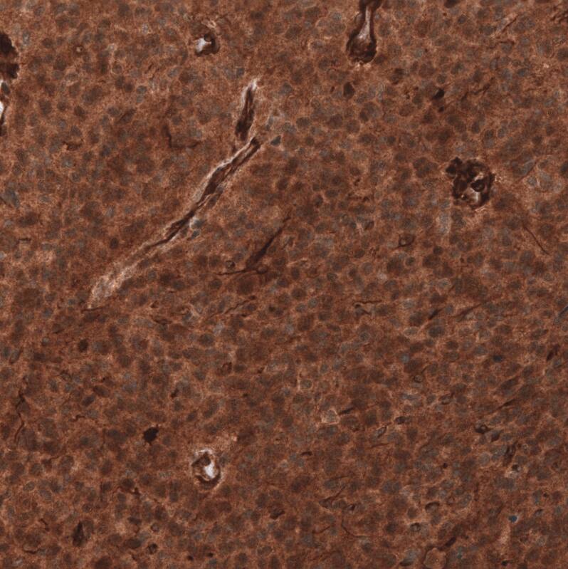 ADAM10 Antibody (CL13814) - Azide and BSA Free Immunohistochemistry-Paraffin: ADAM10 Antibody [NBP3-43826]