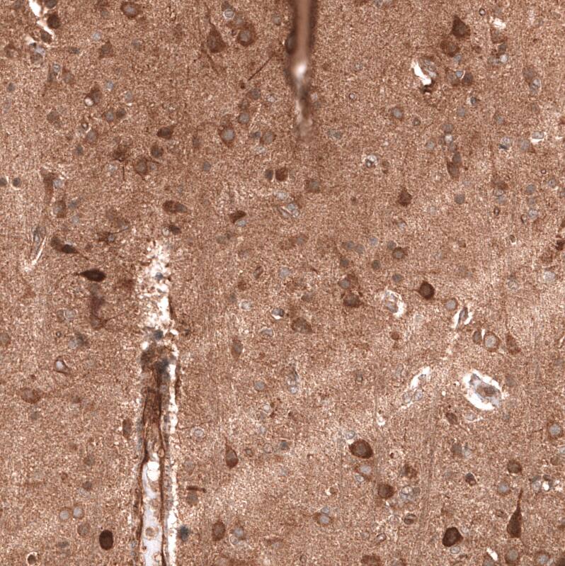 ADAM10 Antibody (CL13814) - Azide and BSA Free Immunohistochemistry-Paraffin: ADAM10 Antibody [NBP3-43826]