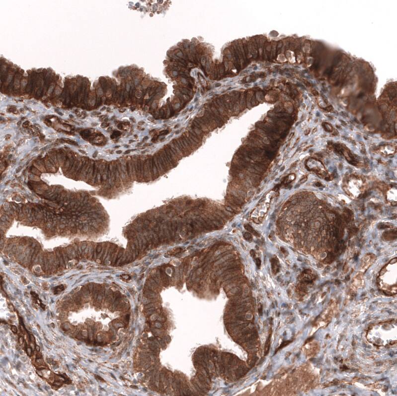 ADAM10 Antibody (CL13814) - Azide and BSA Free Immunohistochemistry-Paraffin: ADAM10 Antibody [NBP3-43826]