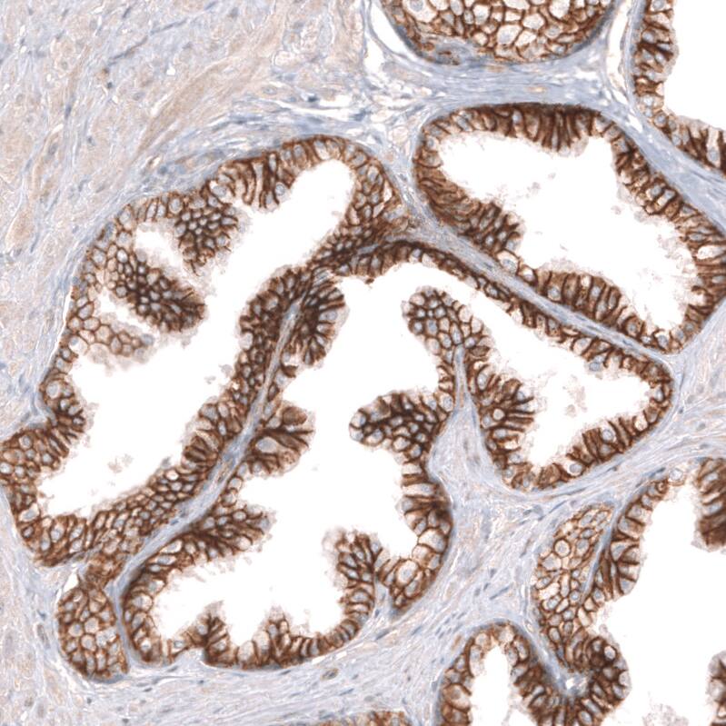 ADAM10 Antibody (CL13814) - Azide and BSA Free Immunohistochemistry-Paraffin: ADAM10 Antibody [NBP3-43826]