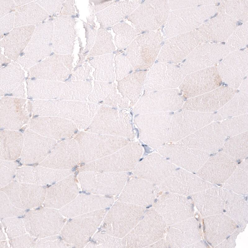 ADAM10 Antibody (CL13814) - Azide and BSA Free Immunohistochemistry-Paraffin: ADAM10 Antibody [NBP3-43826]